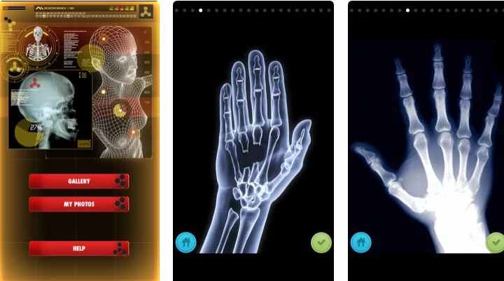 xray to see under clothes